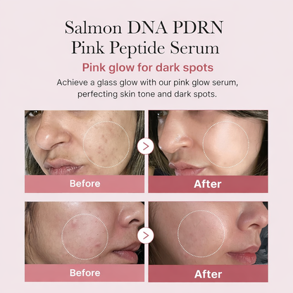 MEDICUBE AGE-R Booster Pro Ex Best Valentine's Day Gift Idea